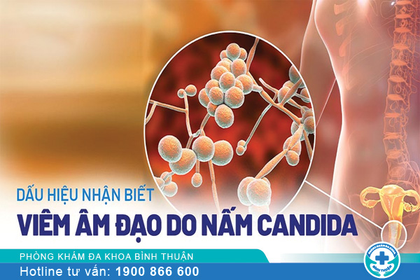 Viêm âm đạo do nấm Candida: Nguyên nhân, triệu chứng và cách điều trị