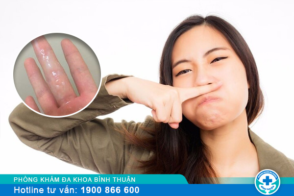 Huyết trắng có mùi hôi là do đâu? Điều trị ra sao?